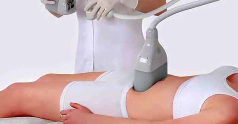 1, 2 Ou 3 Séances De Cryolipolyse Lyon OohN.com Special Offers, Deals & Discounts in France