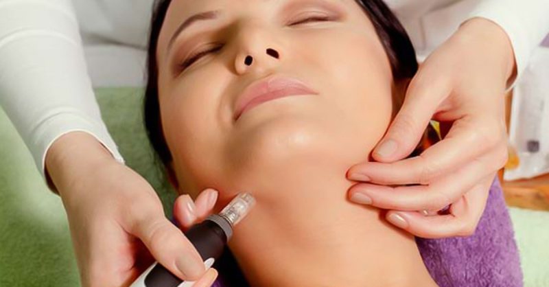 1 Ou 2 Séances De Soin Microneedling Avec Lv Beauté Fréjus – Saint-Raphaël OohN.com Special Offers, Deals & Discounts in France