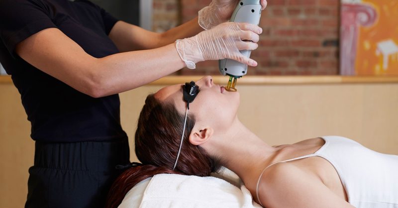 5 Séances Dépilation Laser Diode, Zones Au Choix Montpellier OohN.com Special Offers, Deals & Discounts in France
