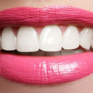 Blanchiment Dentaire Avec Miss.Beautyroom By Carla Essonne OohN.com Special Offers, Deals & Discounts in France