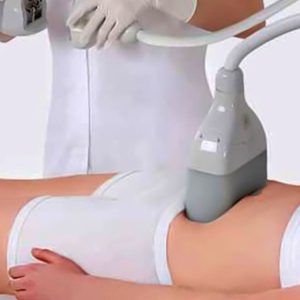 Jusquà 70% De Remise Sur Cryothérapie Chez Sculpt My Body Lyon OohN.com Special Offers, Deals & Discounts in France