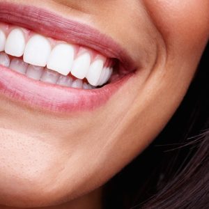 Jusquà 72% De Remise Sur Blanchiment Des Dents – Traditionnel Chez L’Institut Par Point Soleil Paris OohN.com Special Offers, Deals & Discounts in France
