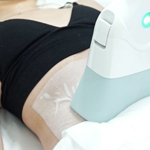 Pour Une Silhouette Plus Svelte : Cryolipolyse Sur 1 Ou 2 Zones Toulouse OohN.com Special Offers, Deals & Discounts in France