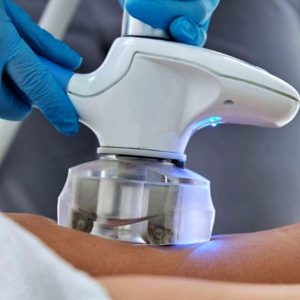 Raffermissez Votre Silhouette En Douceur Avec La Cryolipolyse Montpellier OohN.com Special Offers, Deals & Discounts in France
