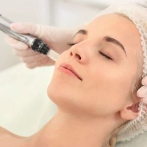 Séance De Microneedling Au Choix Avec Glam Attitude Strasbourg OohN.com Special Offers, Deals & Discounts in France