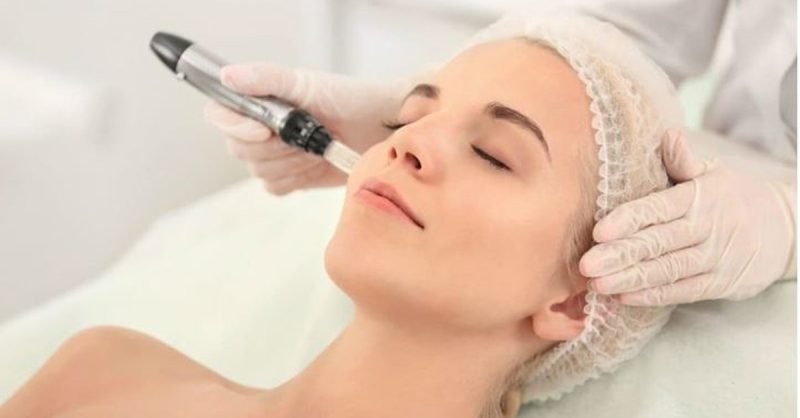 Séance De Microneedling Au Choix Avec Glam Attitude Strasbourg OohN.com Special Offers, Deals & Discounts in France