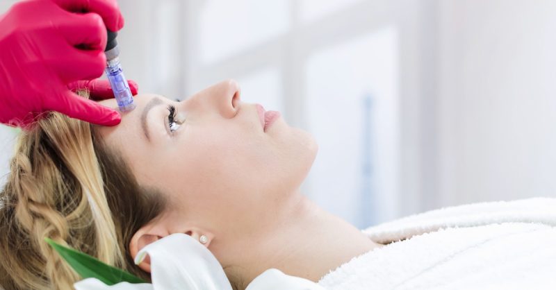 Séance De Microneedling Avec Nissa Beauty Essonne OohN.com Special Offers, Deals & Discounts in France