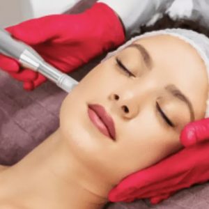 Séance De Microneedling Ou De Bb Glow Avec Estudio Del Tattoo Toulouse OohN.com Special Offers, Deals & Discounts in France