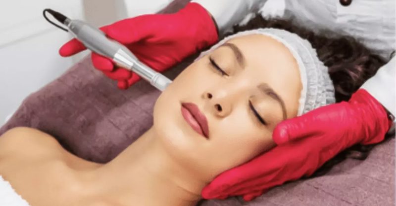 Séance De Microneedling Ou De Bb Glow Avec Estudio Del Tattoo Toulouse OohN.com Special Offers, Deals & Discounts in France