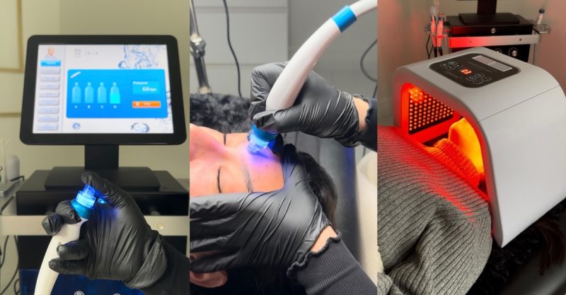 Séance Dhydrafacial Et/Ou De Dermapen Chez Luxeclat Metz OohN.com Special Offers, Deals & Discounts in France