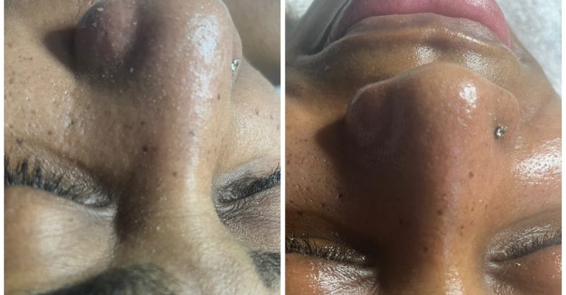 Soin Du Visage Hydratant, Anti-Âge Ou Coup Déclat Chez Mybodyfull Bordeaux OohN.com Special Offers, Deals & Discounts in France 3