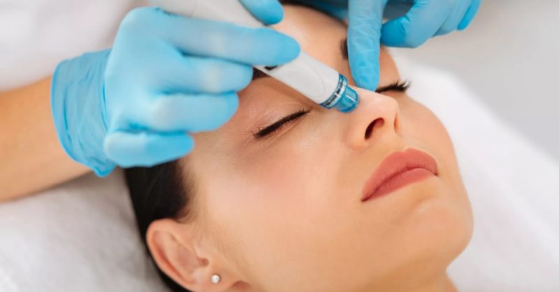 Soin Visage Microneedling Ou Hydrafacial Chez Les Secrets Dève Paris OohN.com Special Offers, Deals & Discounts in France