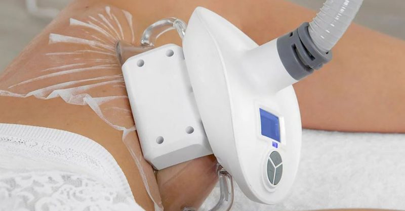 Une Silhouette Affinée Sans Chirurgie ? Découvrez La Cryolipolyse ! Paris OohN.com Special Offers, Deals & Discounts in France 2